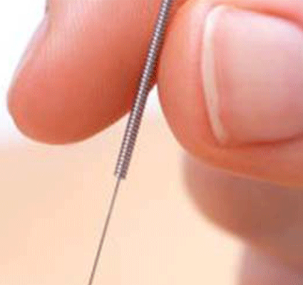 dry-needle