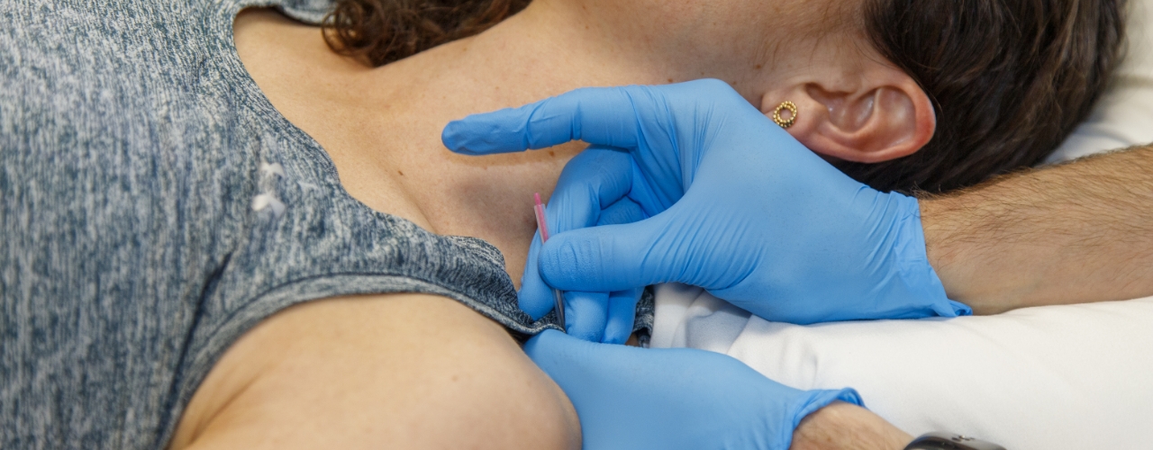 dry-needling-Basecamp-Physical-Therapy-Flagstaff-AZ